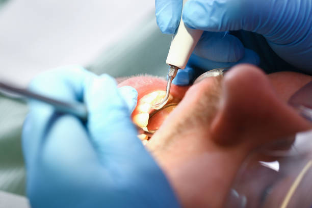 Best Emergency Dental Services for Seniors in Pagedale, MO