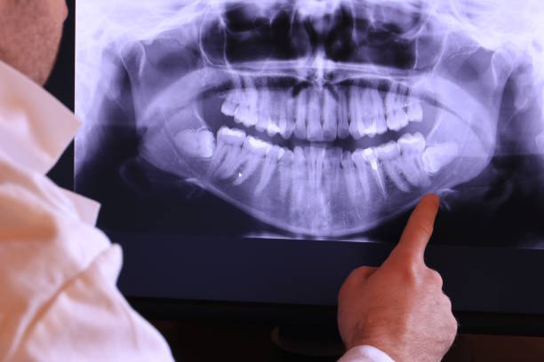 Best Emergency Dentist for Knocked-Out Tooth in Pagedale, MO